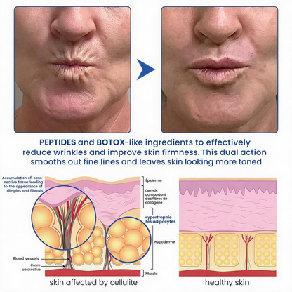 💠🔹🔷🇺🇸 HOT SALE Natravor® PDRN Anti-Wrinkle Shot – Lift & Firming Cream