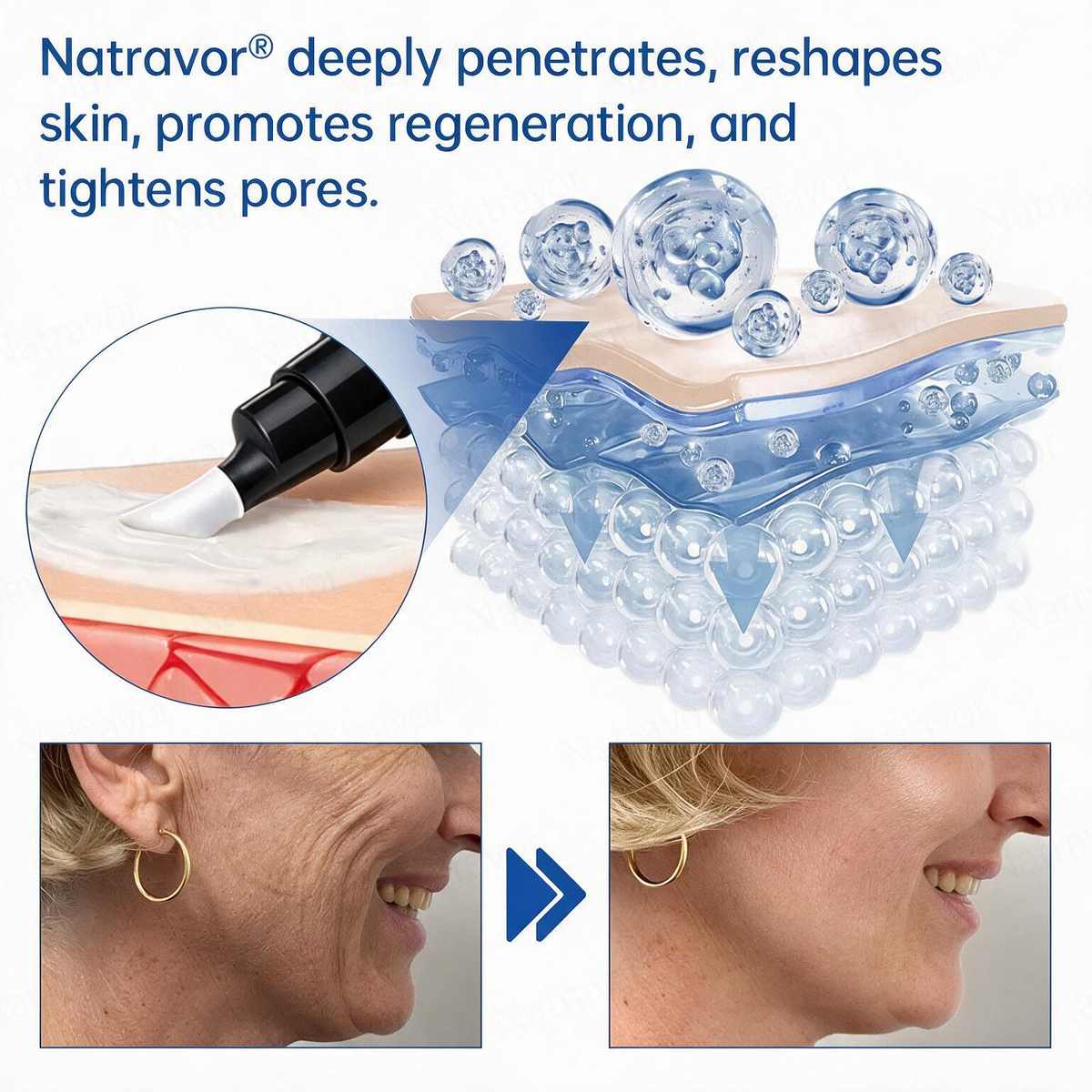 💠🔹🔷🇺🇸 HOT SALE Natravor® PDRN Anti-Wrinkle Shot – Lift & Firming Cream